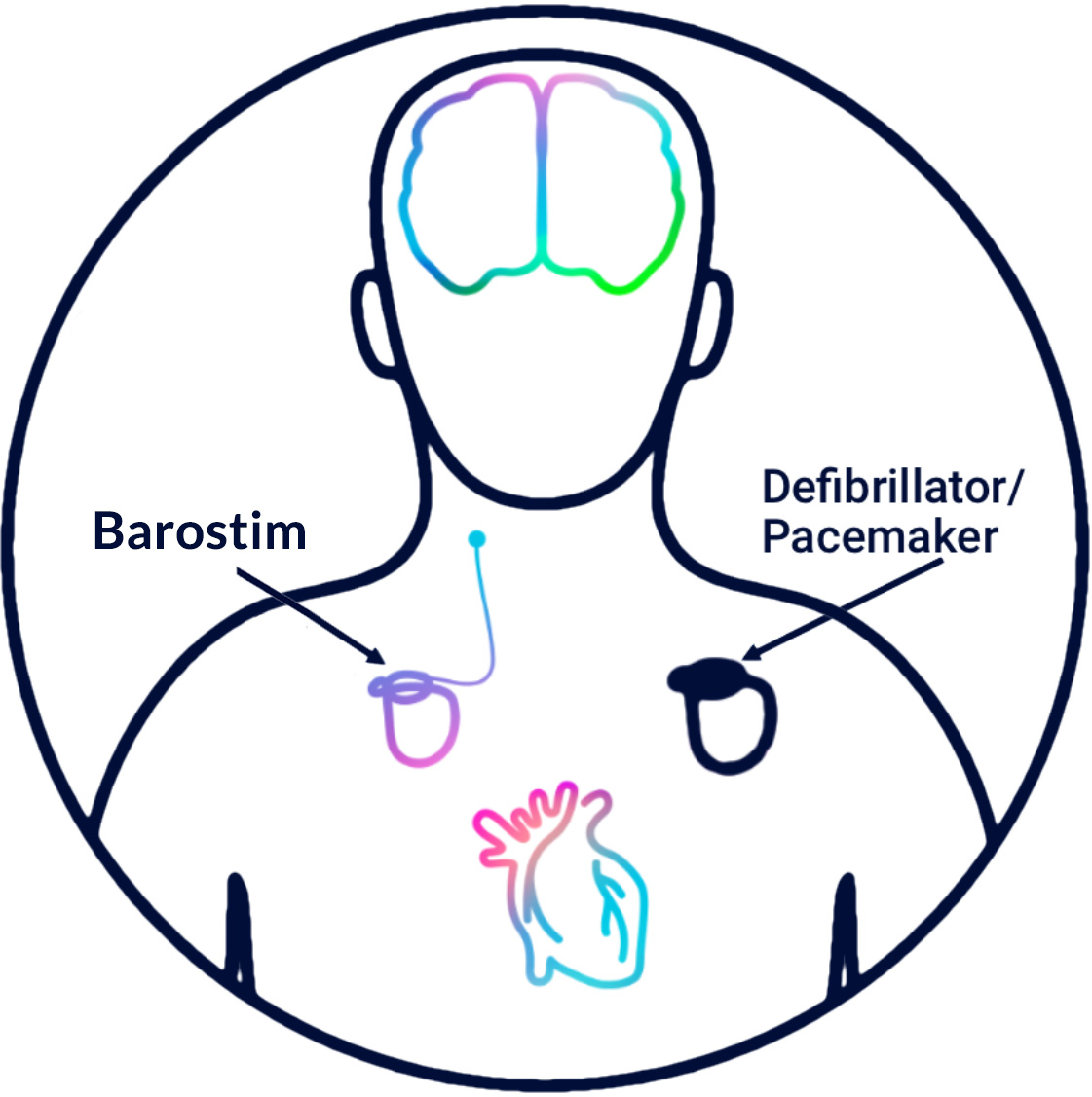 Barostim is not a defibrillator